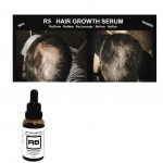 R5生髮液 還你濃密毛髮 倍增自信