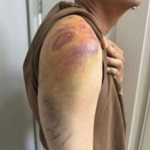 华人在美国Costco被警察打骂 逼其道歉 被控“妨碍公务罪”